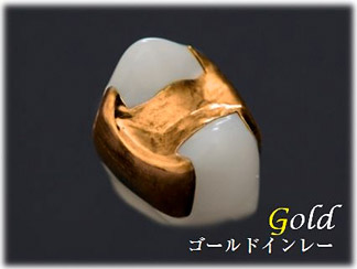 ゴールドインレー