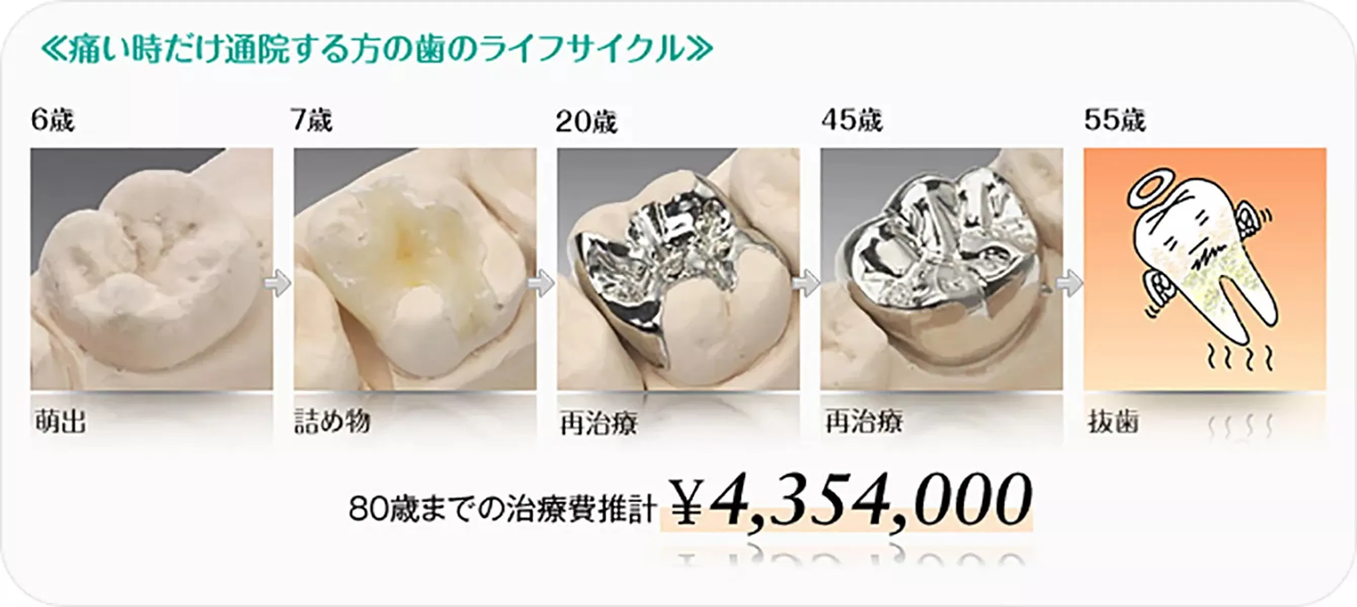 歯のメンテナンス費用高額