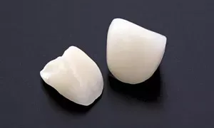 オールセラミッククラウン法の画像