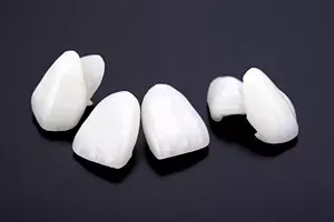 ラミネートベニアのイメージ画像