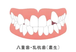 叢生（そうせい）