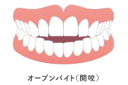 開咬（かいこう）