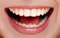 白い歯の画像